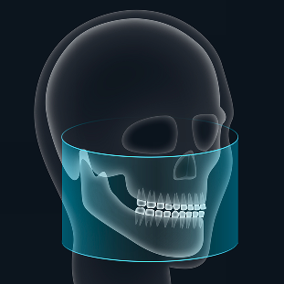 FOV 17 x 10.5 image 1